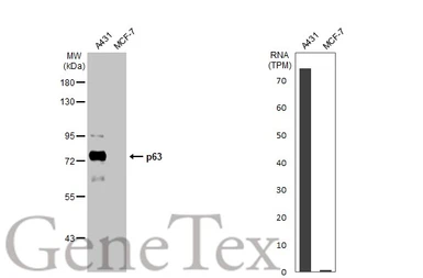 Anti-p63 antibody [HL1027] used in Western Blot (WB). GTX635841