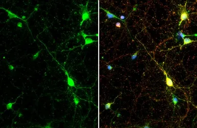 Anti-Synapsin II antibody [GT387] used in Immunocytochemistry/ Immunofluorescence (ICC/IF). GTX635883