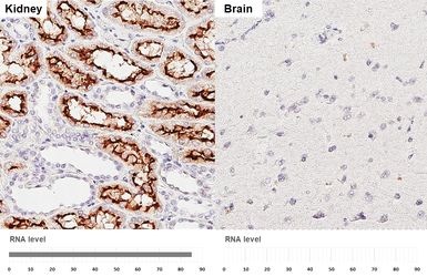 Anti-ACE2 antibody [GT19410] used in IHC (Paraffin sections) (IHC-P). GTX635897
