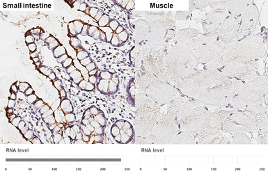 Anti-ACE2 antibody [GT19410] used in IHC (Paraffin sections) (IHC-P). GTX635897