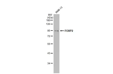 Anti-FOXP2 antibody [GT12812] used in Western Blot (WB). GTX635965