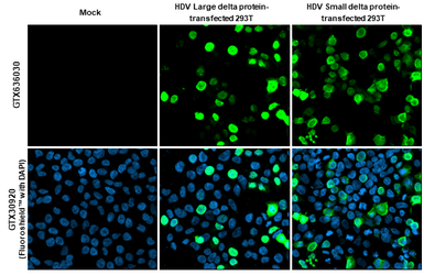 Anti-Hepatitis D virus Large delta + Small delta protein antibody [HL1055] used in Immunocytochemistry/ Immunofluorescence (ICC/IF). GTX636030