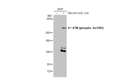 Anti-ATM (phospho Ser1981) antibody [HL1062] used in Western Blot (WB). GTX636086