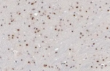 Anti-OLIG2 antibody [HL1072] used in IHC (Paraffin sections) (IHC-P). GTX636104
