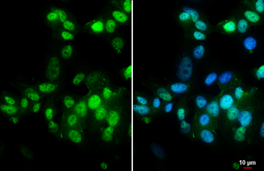 Anti-Estrogen Receptor alpha antibody [HL1081] used in Immunocytochemistry/ Immunofluorescence (ICC/IF). GTX636202