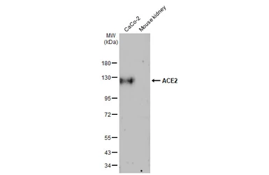 Anti-ACE2 antibody [HL1092] used in Western Blot (WB). GTX636265