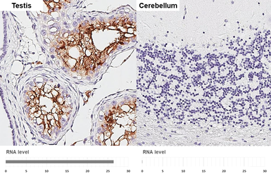 Anti-ACE2 antibody [HL1092] used in IHC (Paraffin sections) (IHC-P). GTX636265
