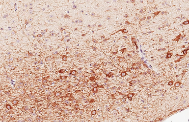 Anti-AChE antibody [HL1102] used in IHC (Paraffin sections) (IHC-P). GTX636298