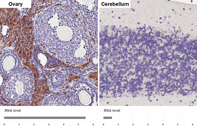 Anti-DDR2 antibody [HL1107] used in IHC (Paraffin sections) (IHC-P). GTX636322
