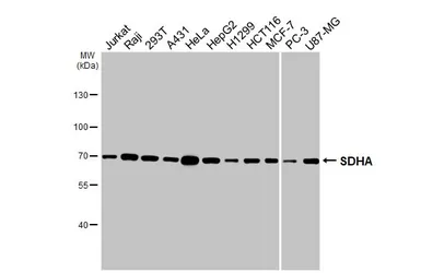 Anti-SDHA antibody [HL1117] used in Western Blot (WB). GTX636335