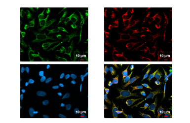 Anti-SDHA antibody [HL1117] used in Immunocytochemistry/ Immunofluorescence (ICC/IF). GTX636335