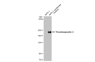 Anti-Thrombospondin 2 antibody [HL1140] used in Western Blot (WB). GTX636411