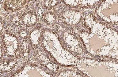Anti-AKT1 antibody [HL1142] used in IHC (Paraffin sections) (IHC-P). GTX636413