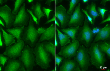 Anti-AKT1 antibody [HL1142] used in Immunocytochemistry/ Immunofluorescence (ICC/IF). GTX636413