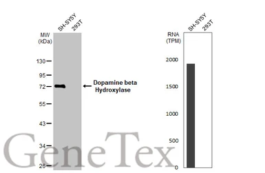 Anti-Dopamine beta Hydroxylase antibody [HL1163] used in Western Blot (WB). GTX636467