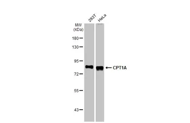 Anti-CPT1A antibody [HL1164] used in Western Blot (WB). GTX636468