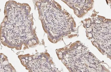 Anti-CPT1A antibody [HL1164] used in IHC (Paraffin sections) (IHC-P). GTX636468