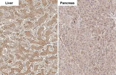 Anti-CPT1A antibody [HL1164] used in IHC (Paraffin sections) (IHC-P). GTX636468
