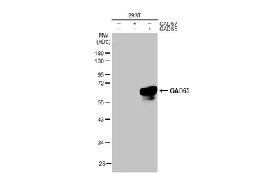 Anti-GAD65 antibody [HL1187] used in Western Blot (WB). GTX636493