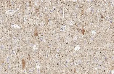 Anti-GAD65 antibody [HL1187] used in IHC (Paraffin sections) (IHC-P). GTX636493