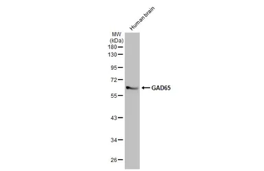 Anti-GAD65 antibody [HL1187] used in Western Blot (WB). GTX636493