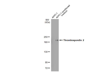 Anti-Thrombospondin 2 antibody [HL1194] used in Western Blot (WB). GTX636506