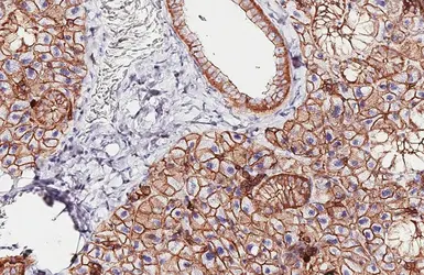 Anti-E-Cadherin antibody [HL1229] used in IHC (Paraffin sections) (IHC-P). GTX636577
