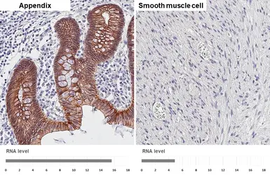 Anti-E-Cadherin antibody [HL1229] used in IHC (Paraffin sections) (IHC-P). GTX636577