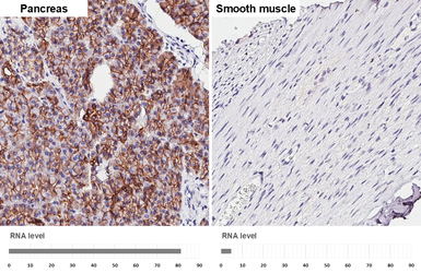 Anti-E-Cadherin antibody [HL1229] used in IHC (Paraffin sections) (IHC-P). GTX636577