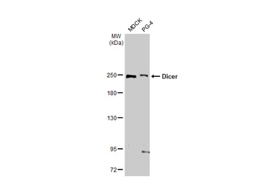 Anti-Dicer antibody [HL1232] used in Western Blot (WB). GTX636580