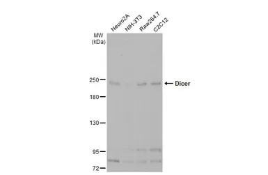 Anti-Dicer antibody [HL1232] used in Western Blot (WB). GTX636580