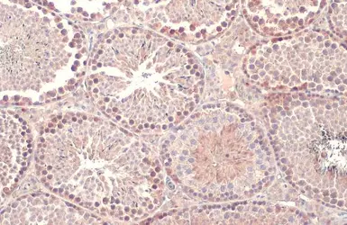 Anti-Dicer antibody [HL1232] used in IHC (Paraffin sections) (IHC-P). GTX636580