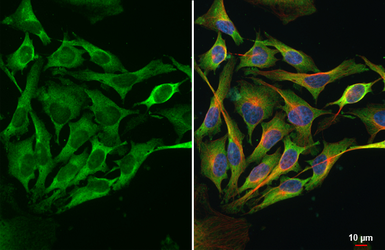 Anti-Dicer antibody [HL1232] used in Immunocytochemistry/ Immunofluorescence (ICC/IF). GTX636580