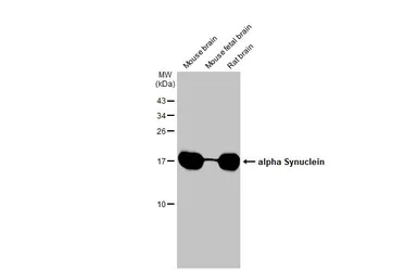 Anti-alpha Synuclein antibody [HL1242] used in Western Blot (WB). GTX636641