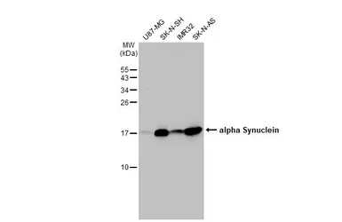 Anti-alpha Synuclein antibody [HL1242] used in Western Blot (WB). GTX636641