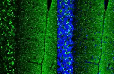 Anti-alpha Synuclein antibody [HL1242] used in IHC (Frozen sections) (IHC-Fr). GTX636641