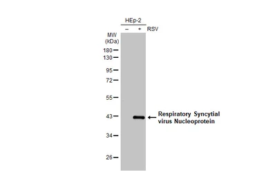 Anti-Respiratory Syncytial virus Nucleoprotein antibody [HL1247] used in Western Blot (WB). GTX636649