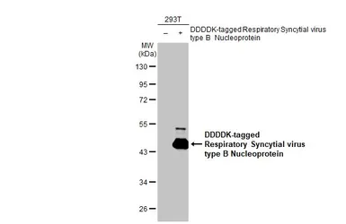 Anti-Respiratory Syncytial virus Nucleoprotein antibody [HL1248] used in Western Blot (WB). GTX636650