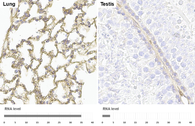 Anti-Integrin beta 1 / CD29 antibody [HL1255] used in IHC (Paraffin sections) (IHC-P). GTX636657