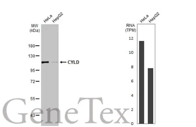 Anti-CYLD antibody [HL1260] used in Western Blot (WB). GTX636662