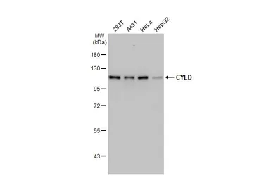 Anti-CYLD antibody [HL1261] used in Western Blot (WB). GTX636663