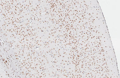 Anti-NFIX antibody [HL1269] used in IHC (Paraffin sections) (IHC-P). GTX636671
