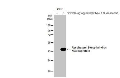 Anti-Respiratory Syncytial virus Nucleoprotein antibody [HL1295] used in Western Blot (WB). GTX636709