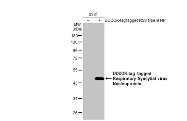 Anti-Respiratory Syncytial virus Nucleoprotein antibody [HL1295] used in Western Blot (WB). GTX636709