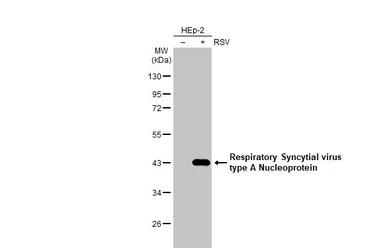 Anti-Respiratory Syncytial virus type A Nucleoprotein antibody [HL1297] used in Western Blot (WB). GTX636711