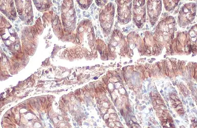 Anti-EpCAM antibody [HL1339] used in IHC (Paraffin sections) (IHC-P). GTX636759