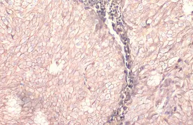 Anti-EpCAM antibody [HL1339] used in IHC (Paraffin sections) (IHC-P). GTX636759