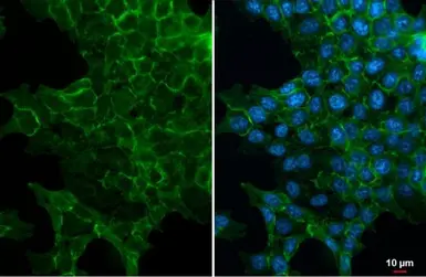 Anti-EpCAM antibody [HL1339] used in Immunocytochemistry/ Immunofluorescence (ICC/IF). GTX636759