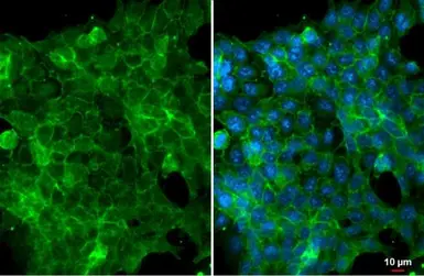 Anti-EpCAM antibody [HL1339] used in Immunocytochemistry/ Immunofluorescence (ICC/IF). GTX636759