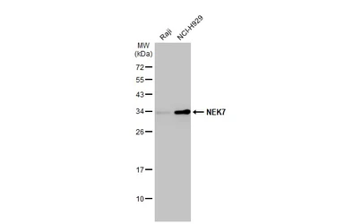 Anti-NEK7 antibody [HL1349] used in Western Blot (WB). GTX636769